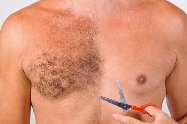 body-hair-transplant-jpg