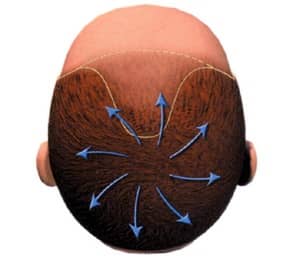 crown vertex