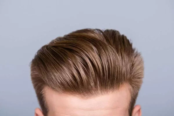 when-does-the-transplanted-hair-regrow-jpg